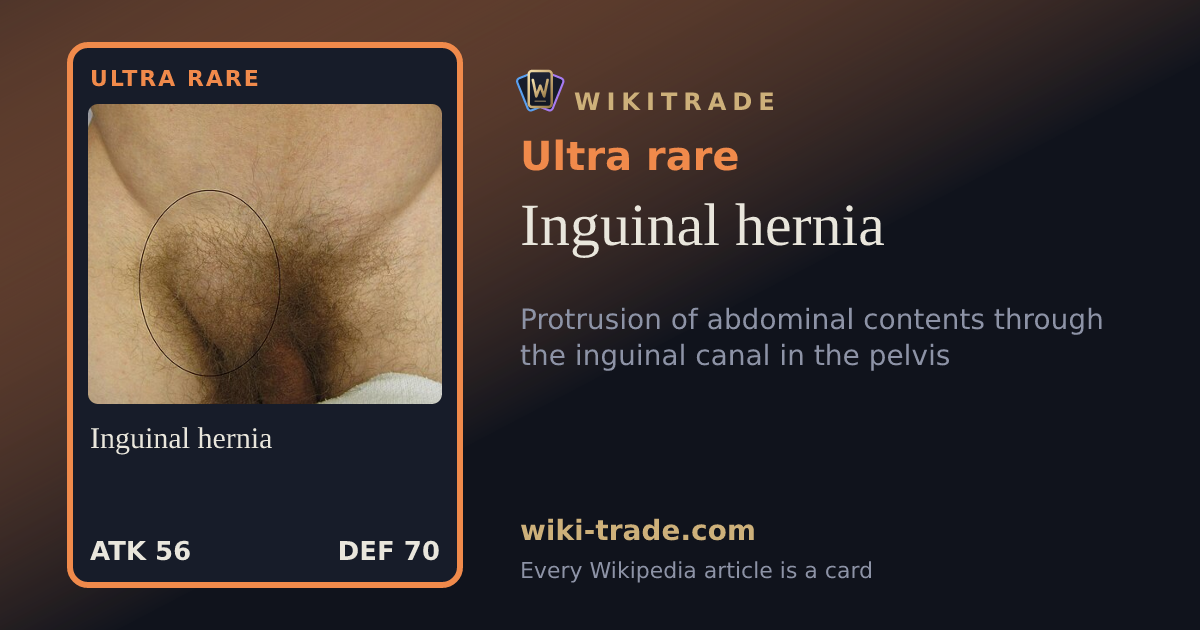 Inguinal hernia — Ultra rare card