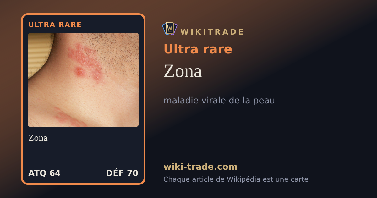 Zona — carte Ultra rare