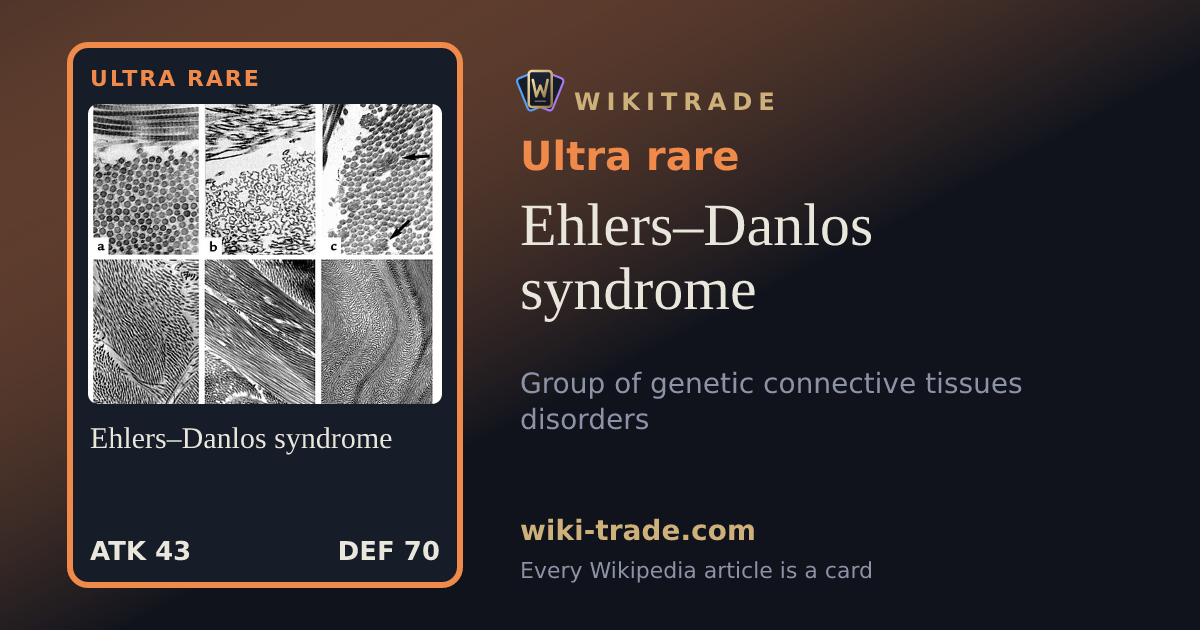 Ehlers–Danlos syndrome — Ultra rare card