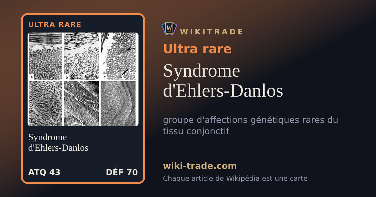 Syndrome d'Ehlers-Danlos — carte Ultra rare
