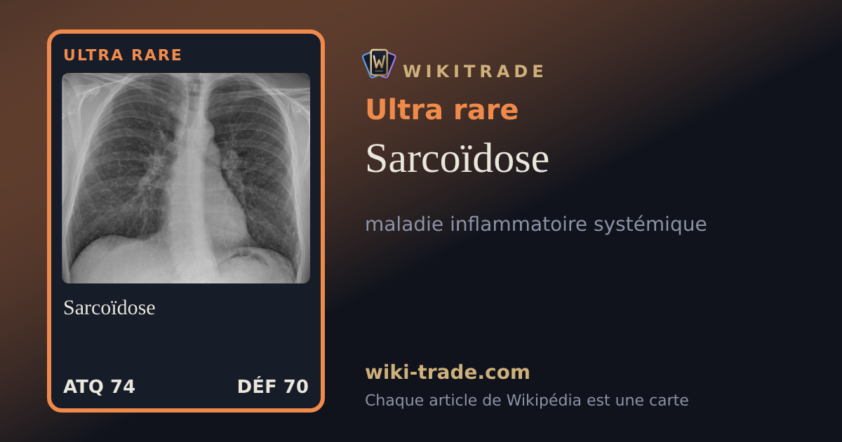 Sarcoïdose — carte Ultra rare
