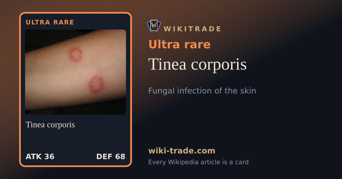 Tinea corporis — Ultra rare card
