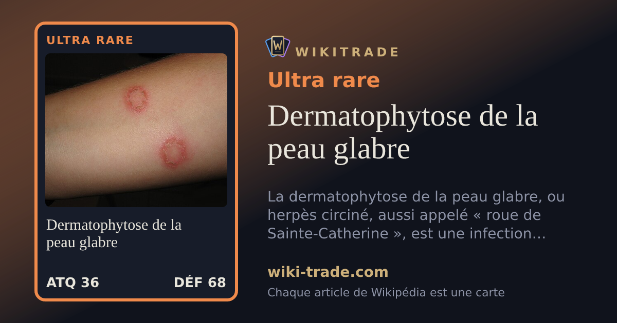 Dermatophytose de la peau glabre — carte Ultra rare