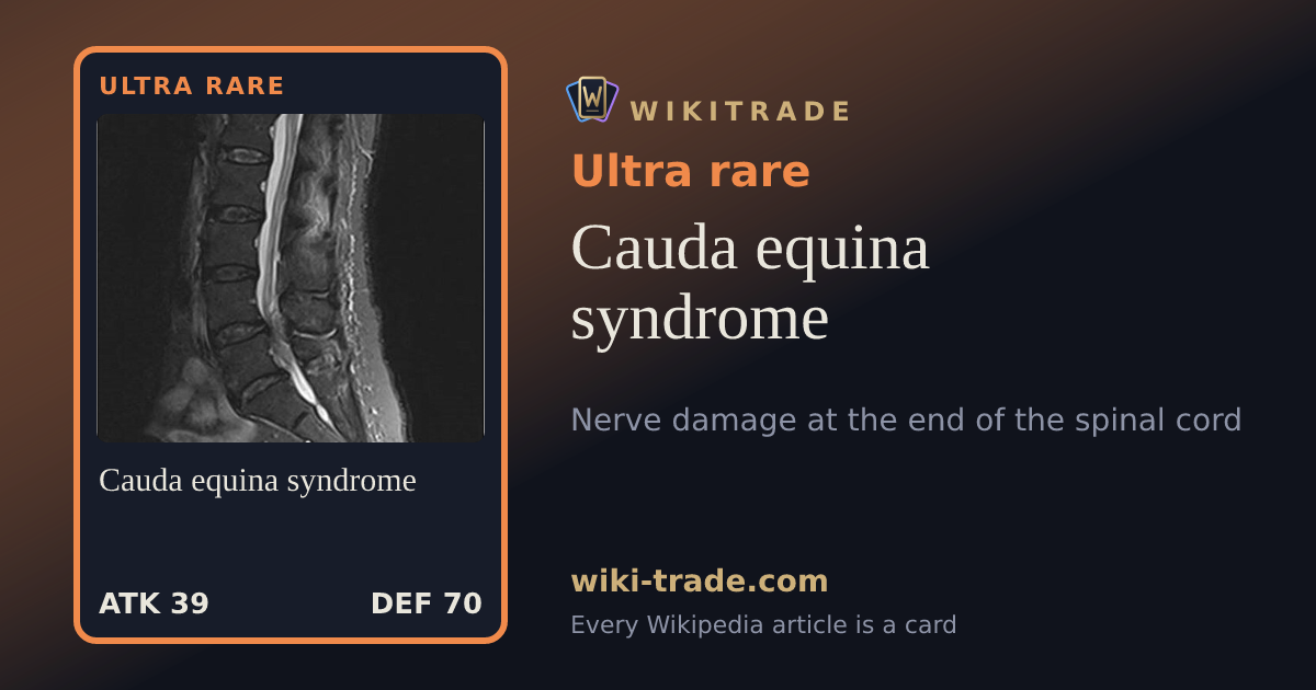 Cauda equina syndrome — Ultra rare card
