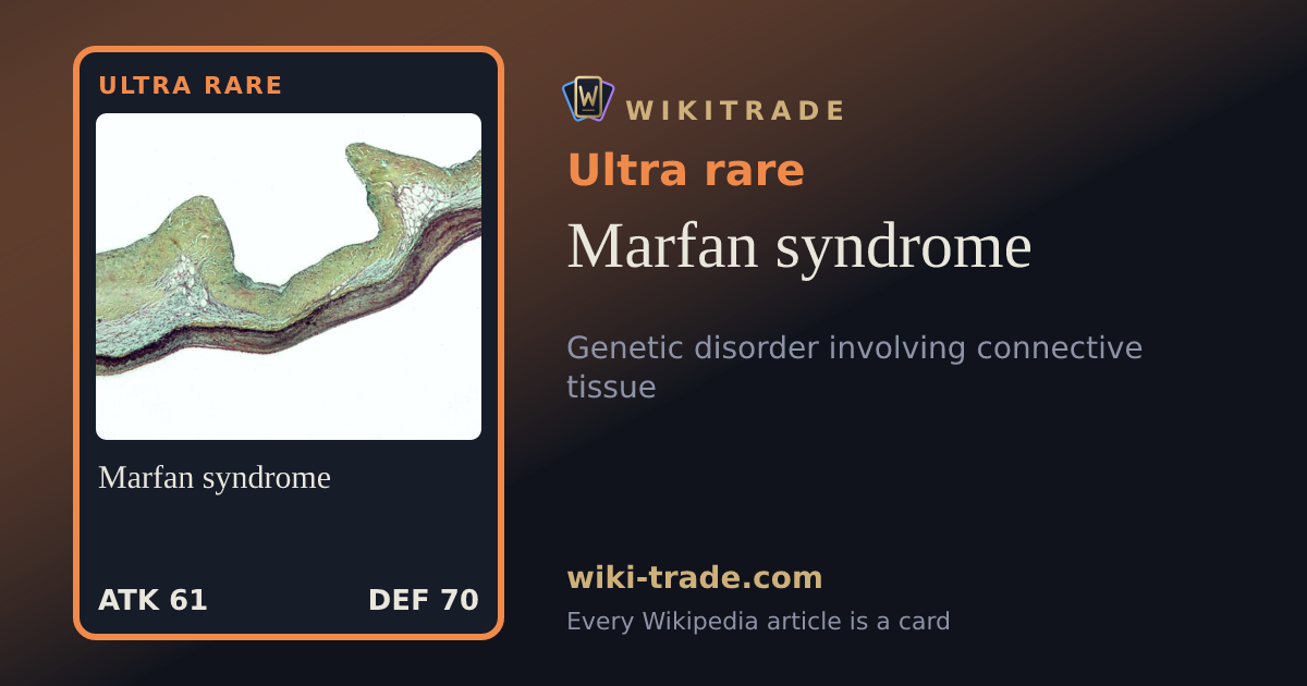 Marfan syndrome — Ultra rare card