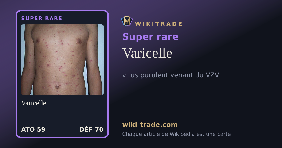 Varicelle — carte Super rare