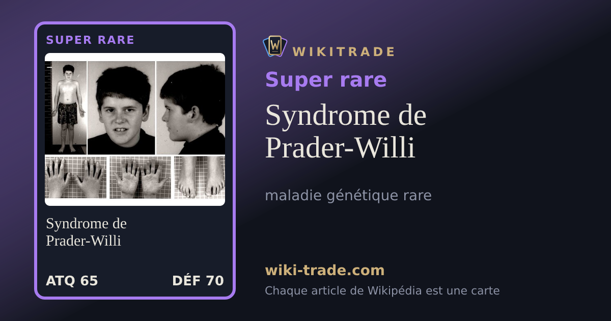Syndrome de Prader-Willi — carte Super rare