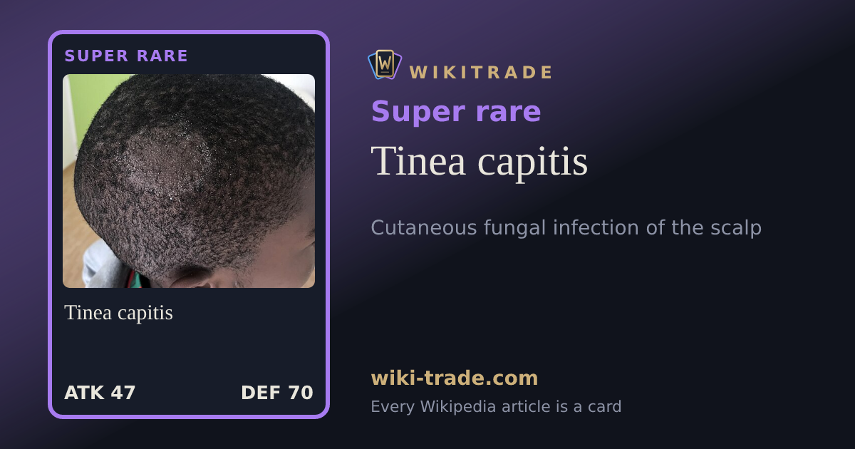 Tinea capitis — Super rare card