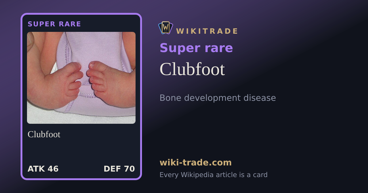 Clubfoot — Super rare card