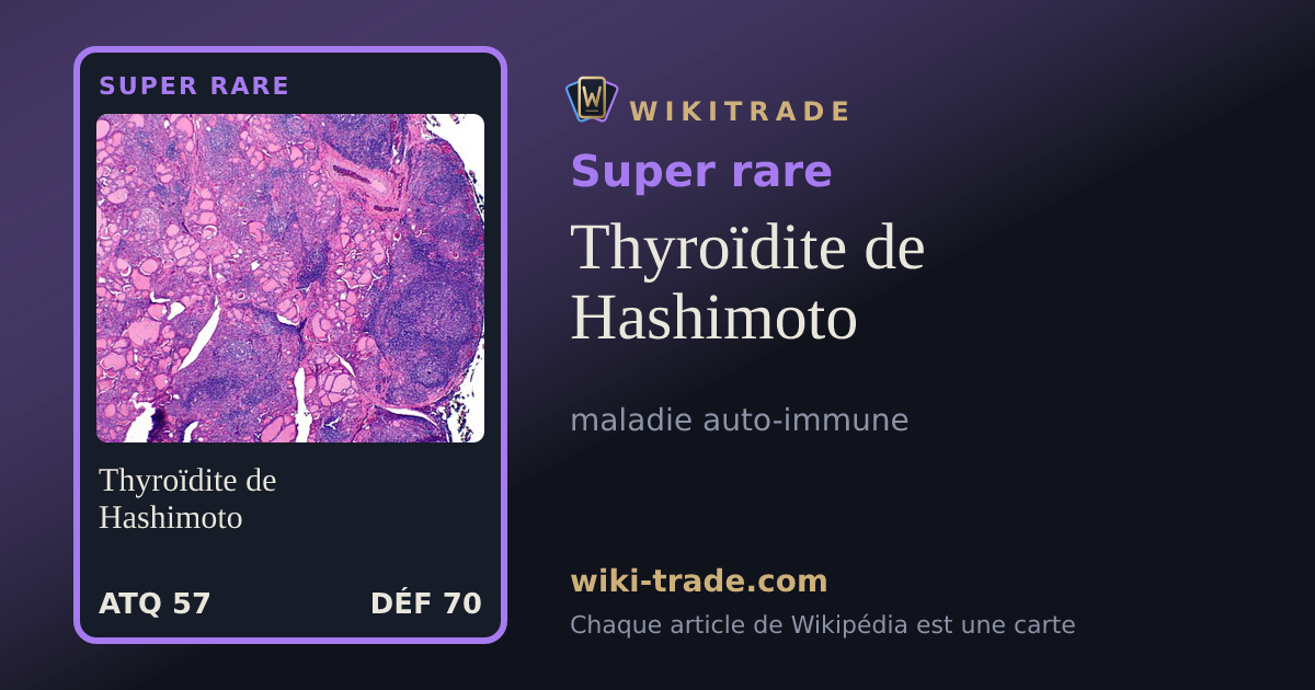 Thyroïdite de Hashimoto — carte Super rare