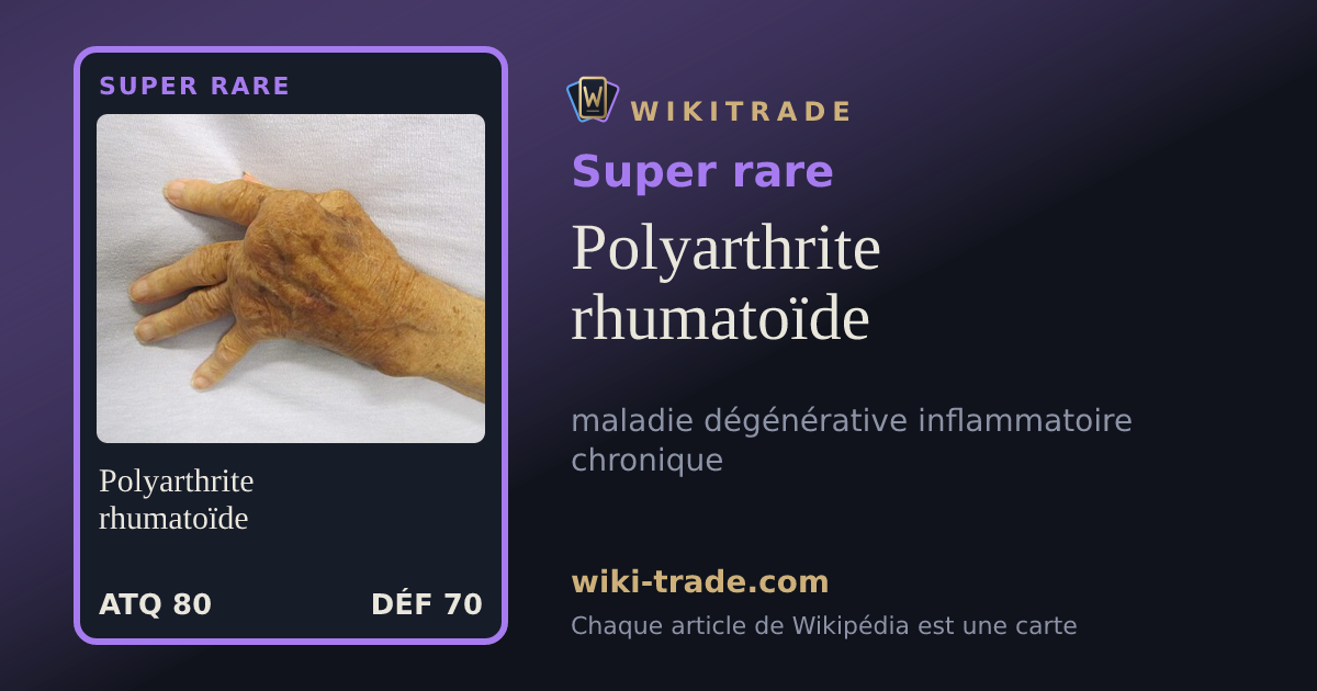 Polyarthrite rhumatoïde — carte Super rare