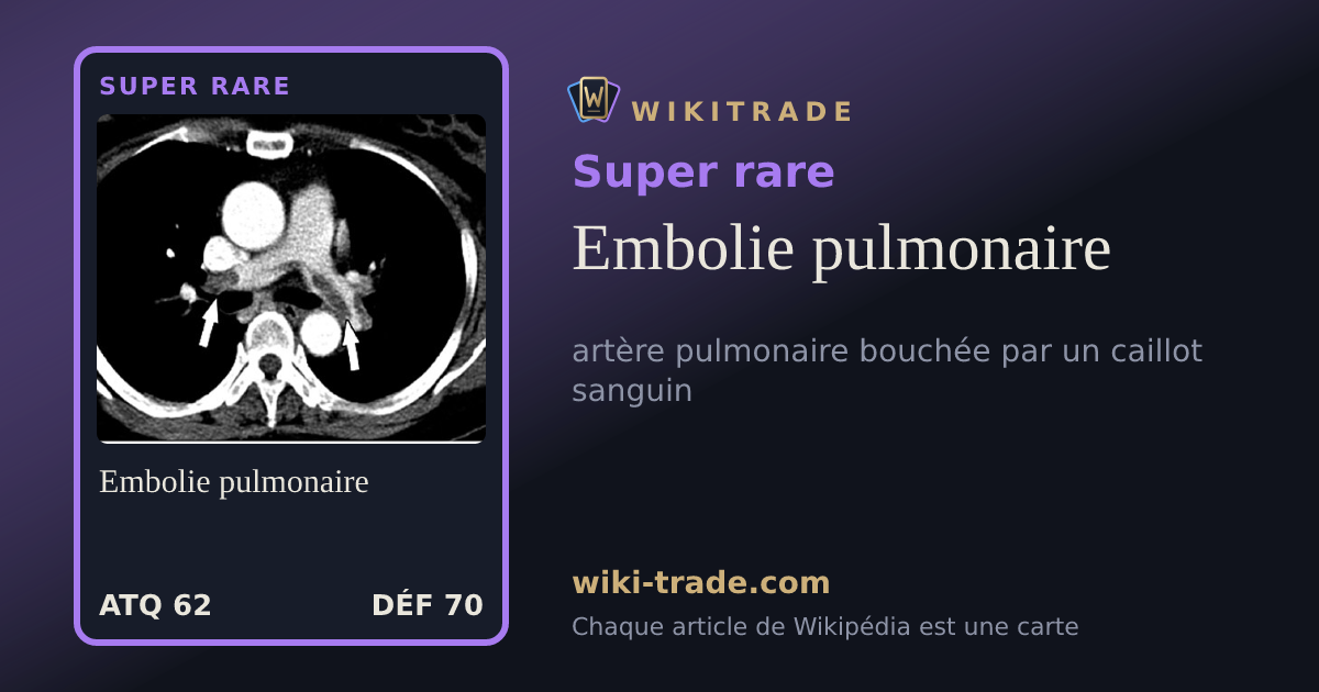 Embolie pulmonaire — carte Super rare