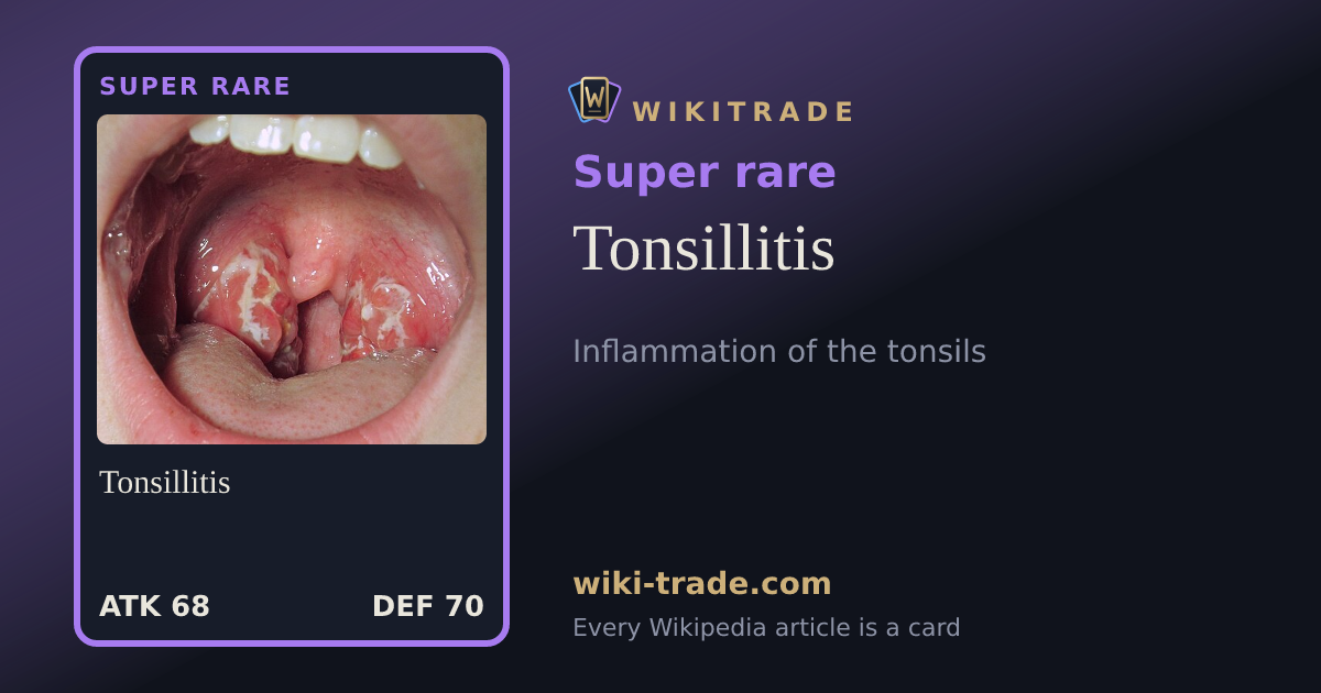 Tonsillitis — Super rare card