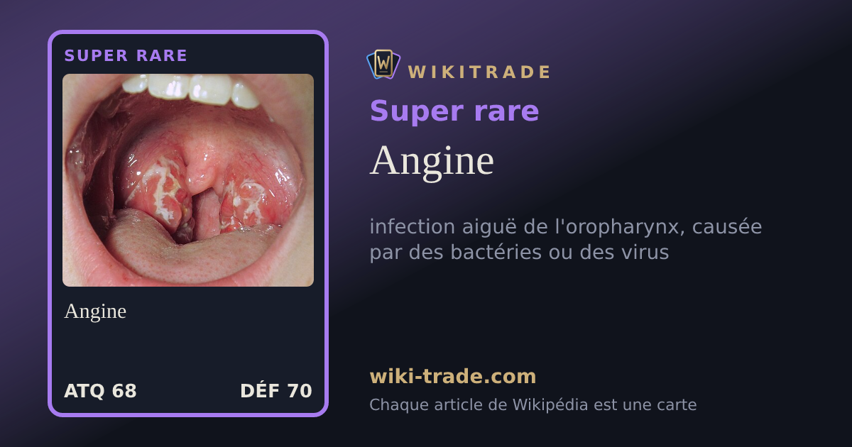 Angine — carte Super rare