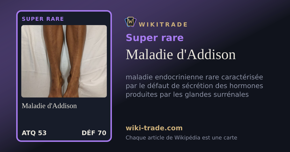 Maladie d'Addison — carte Super rare