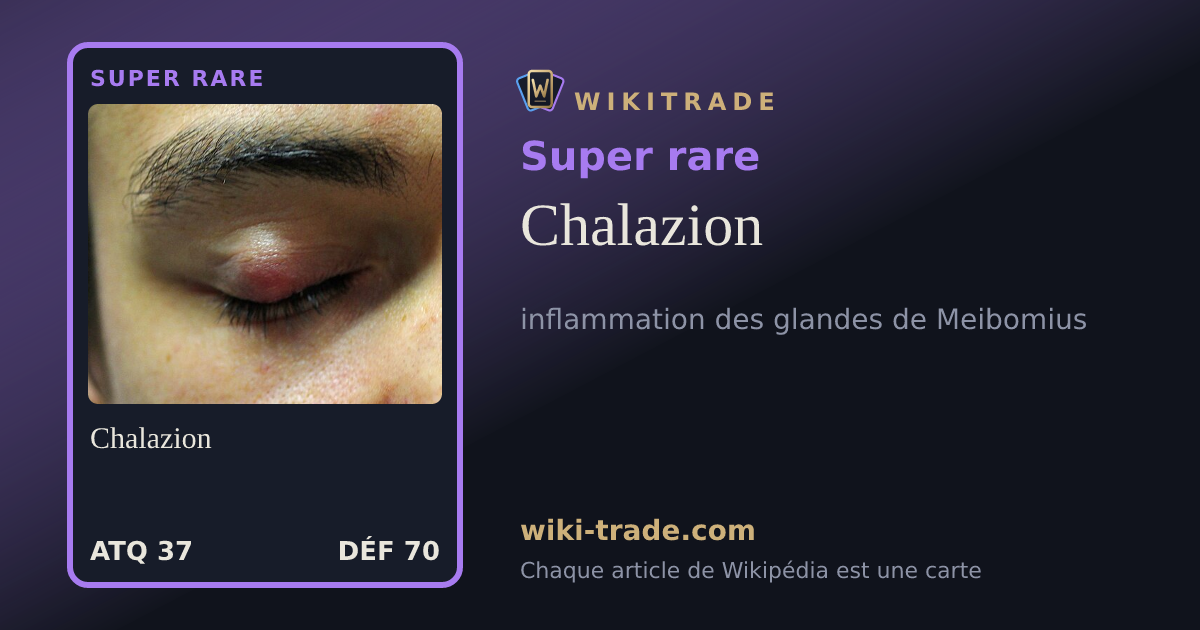 Chalazion — carte Super rare