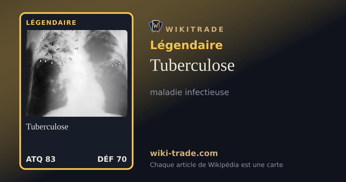 Tuberculose — carte Légendaire
